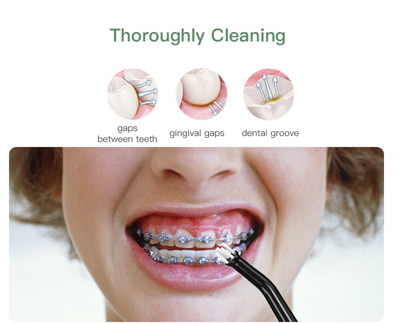 Portable Rechargeable Oral Irrigator - Image 8